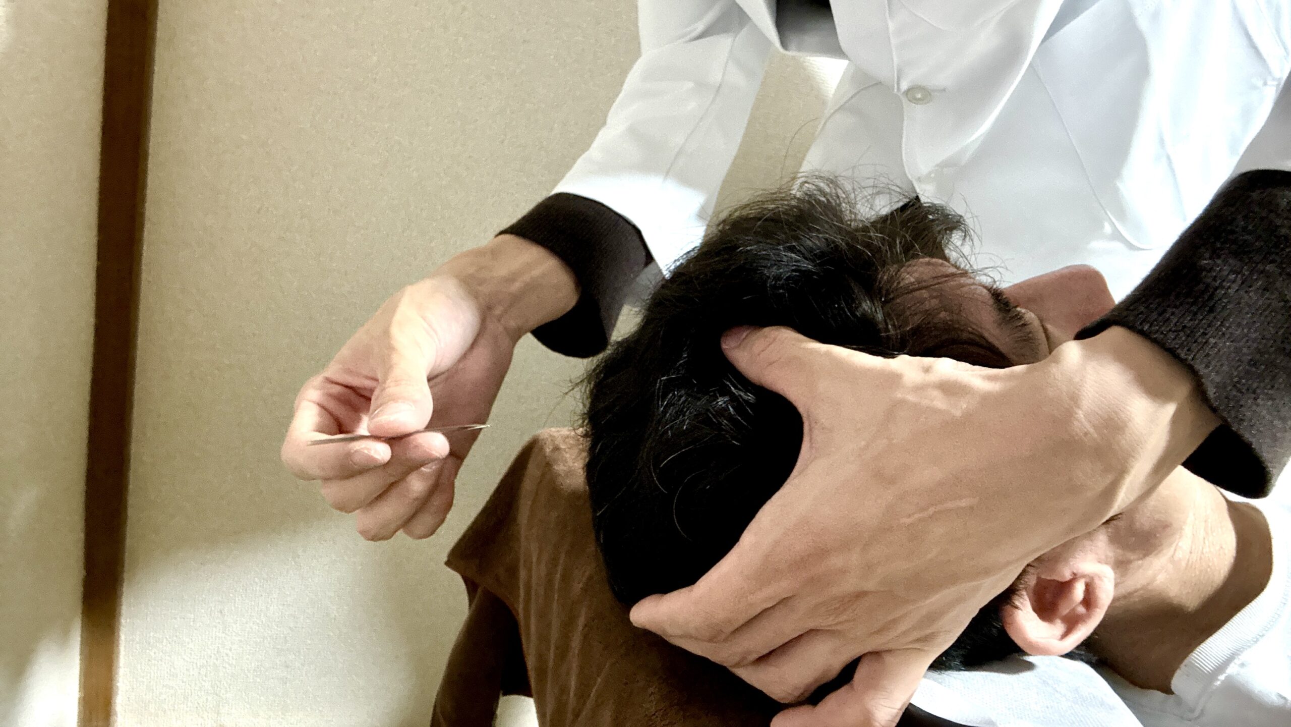 頭部への古代鍼（刺さない鍼）治療